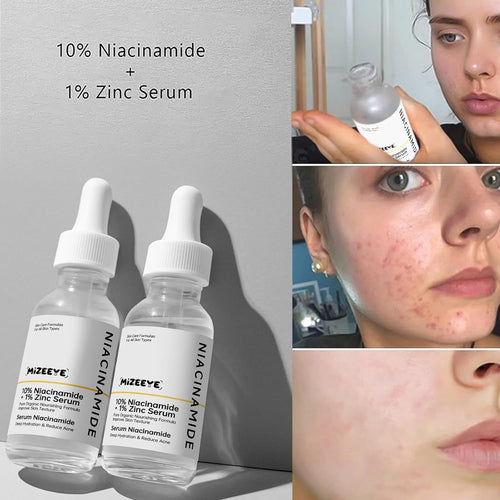 Niacinamide 10% + Zinc 1% Serum for Face, 30ML/1 Fl Oz Moisture Niacinamide Face Serum for Women, Refreshing.
