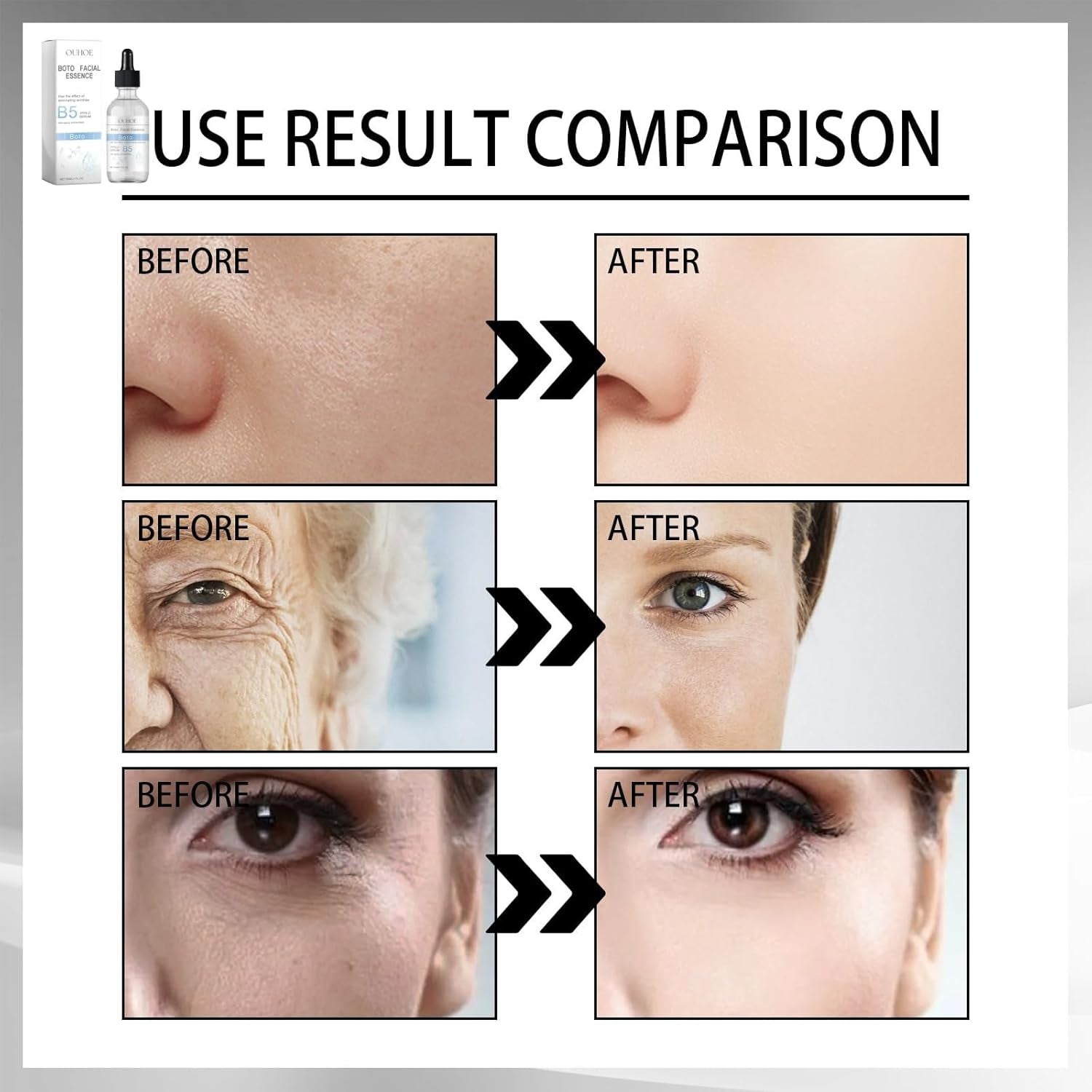 Boto Face Serum for Women,Boto Stock Solution B5,Anti Aging Serum for Face,Hydrating Serum,Niacinamide Serum,Hyaluronic Acid Serum,Anti Wrinkle Face Cream,Collagen Serum for Face,Facial Moisturiser